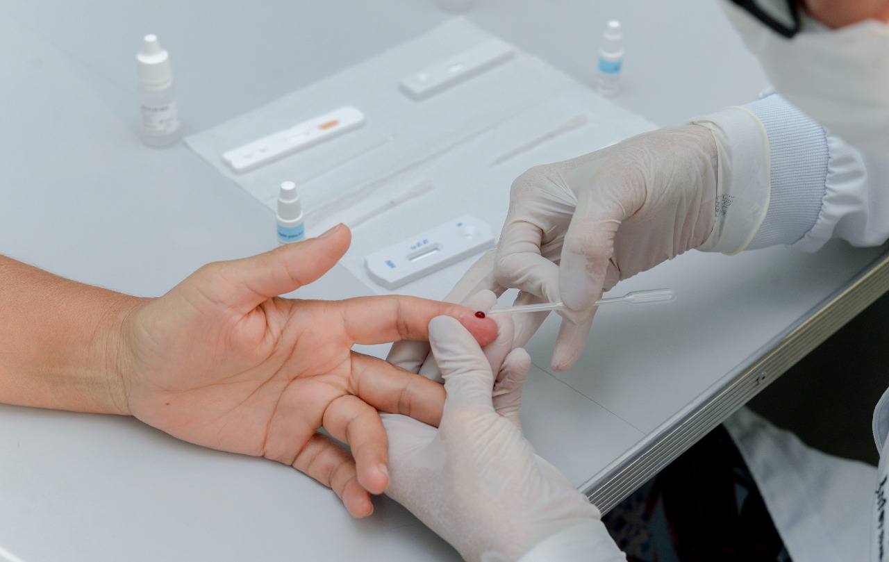 Prefeitura de Palmas oferece gratuitamente Profilaxia Pré-Exposição ao HIV